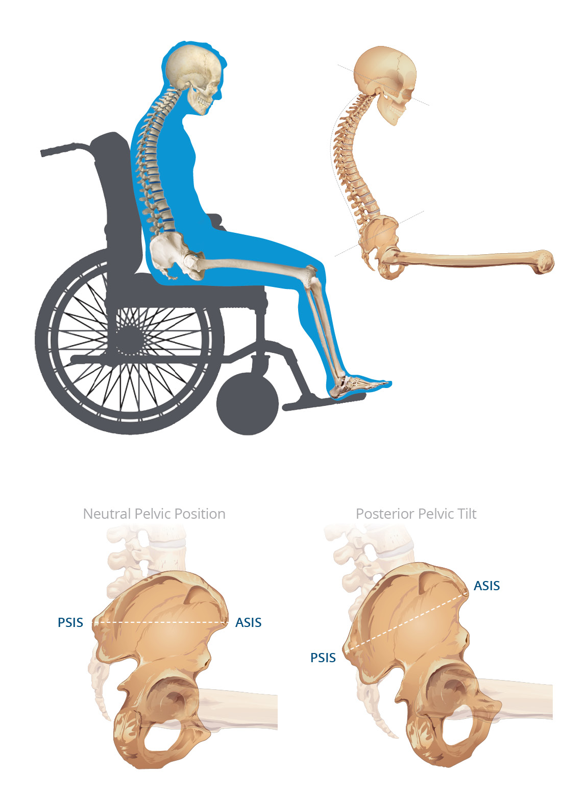 Anterior pelvic tilt online chair support